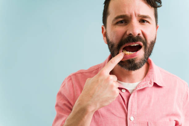 Gum Disease You Should Never Ignore